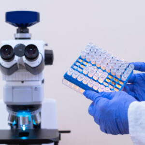 A,Scientist,Holds,A,Blue,Laboratory,Tripod,With,Vaccines,Against